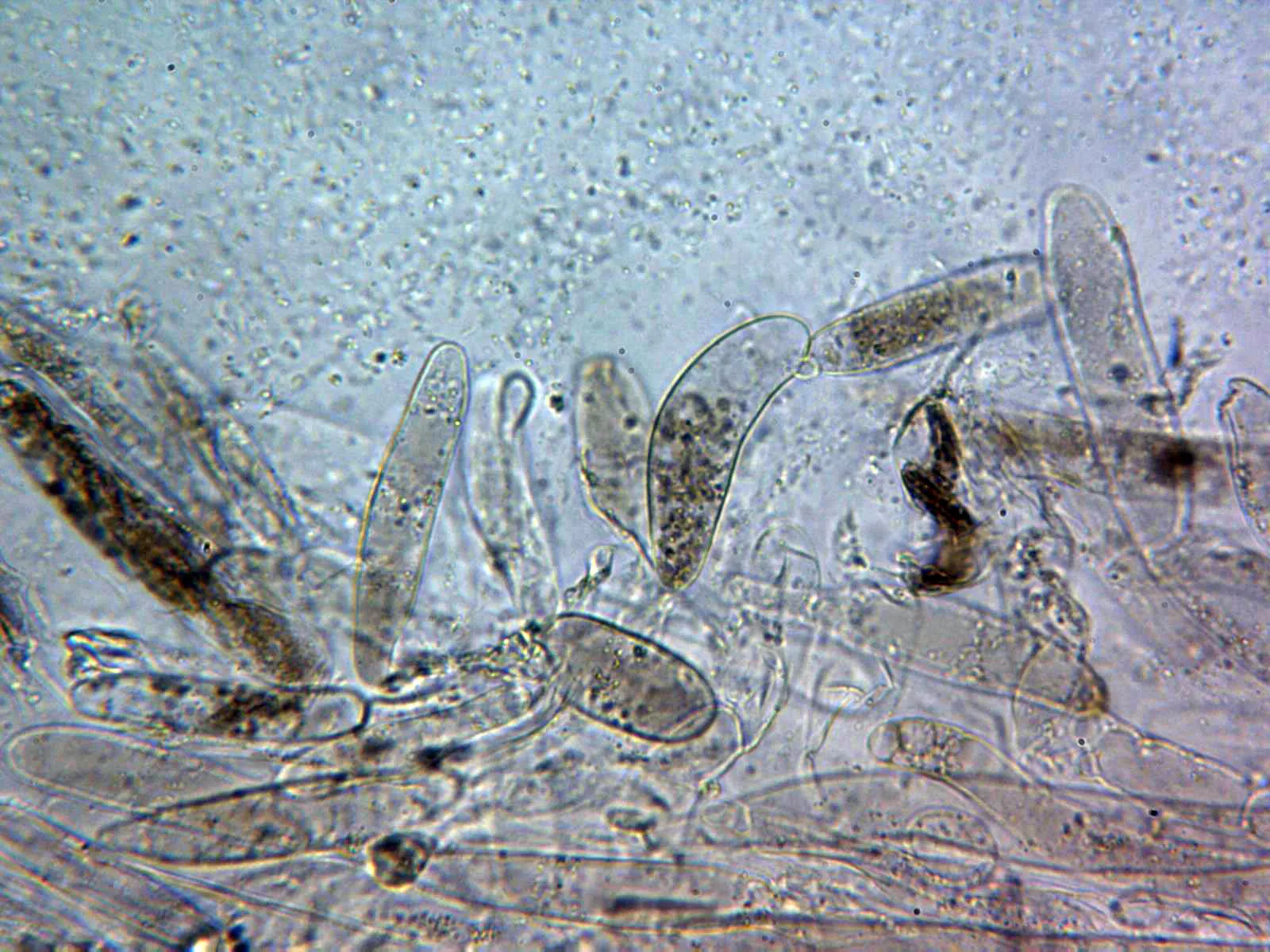 10 - Suprapellis agua x 400 2